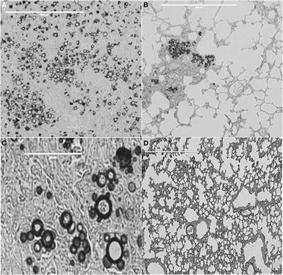 Linear Epitopes of Paracoccidioides brasiliensis and Other Fungal Agents of Human Systemic Mycoses As Vaccine Candidates